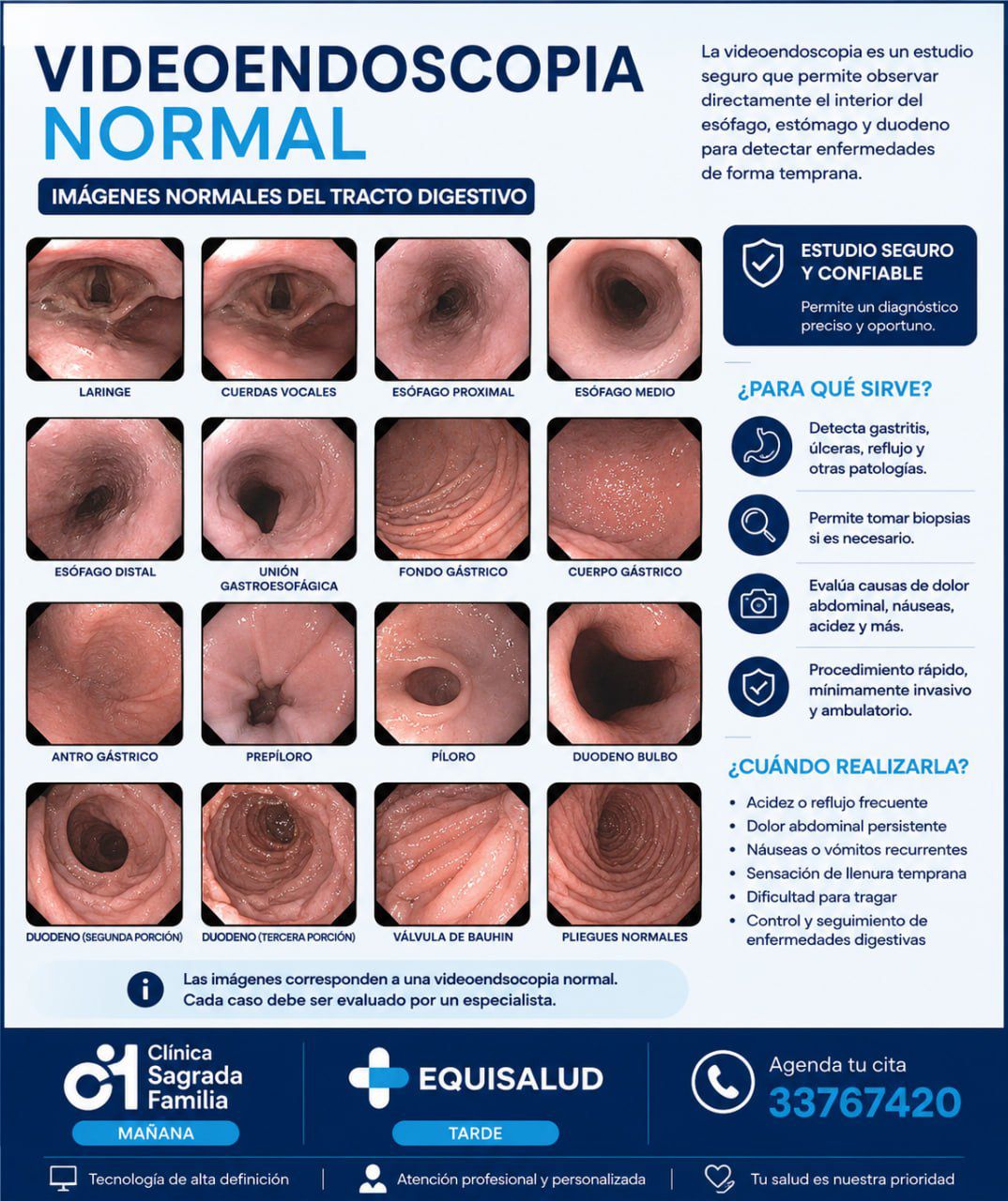 Endoscopia