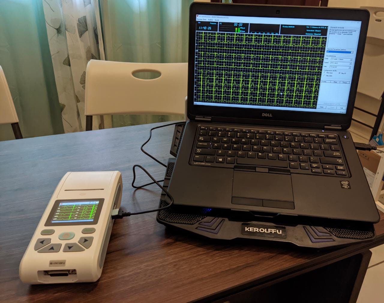 Lector de Electrocardiograma 