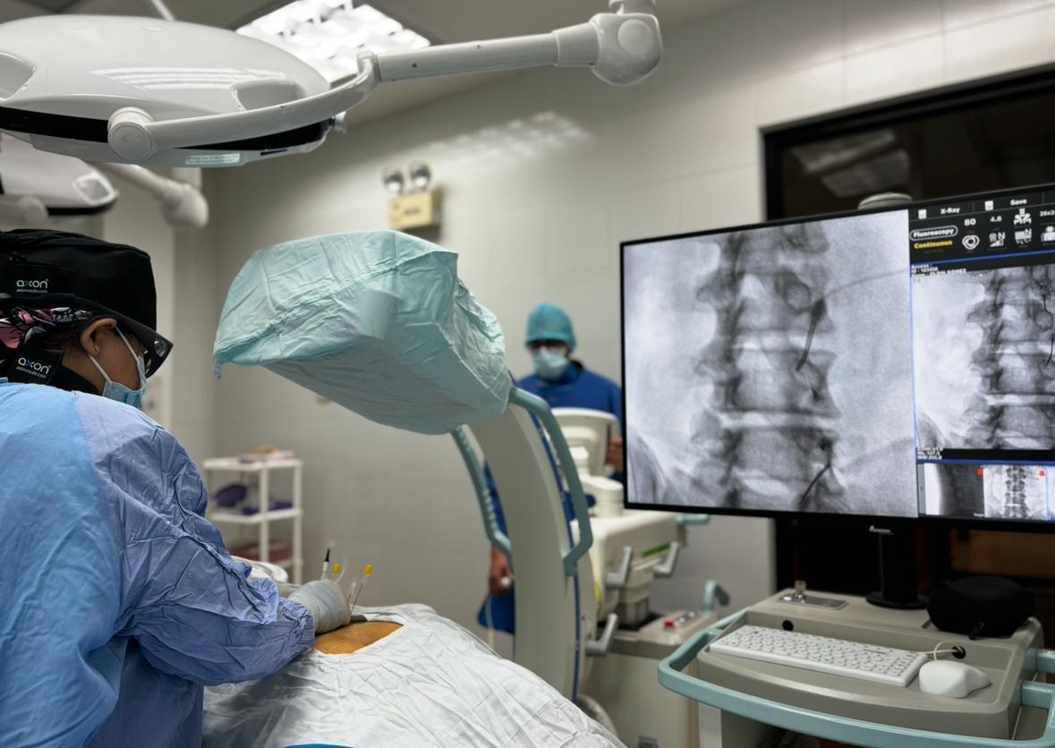 Radiofrecuencia de facetas lumbares